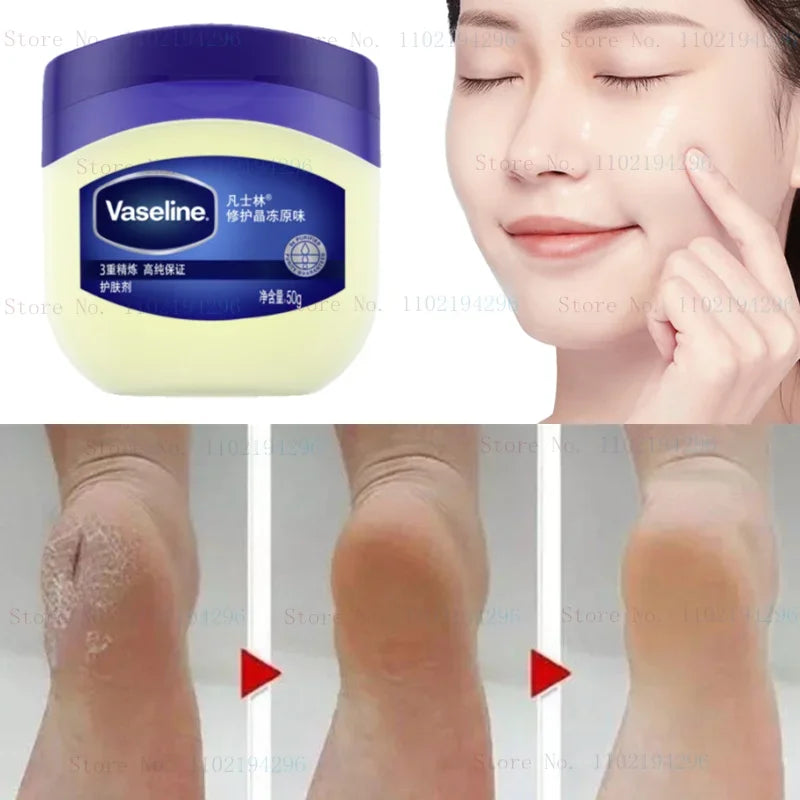 Vaseline Body Repair Cream Moisturizing Water Locking Hand and Foot Crack Cream No Fragrance Nourishes and Brightens Skin Color