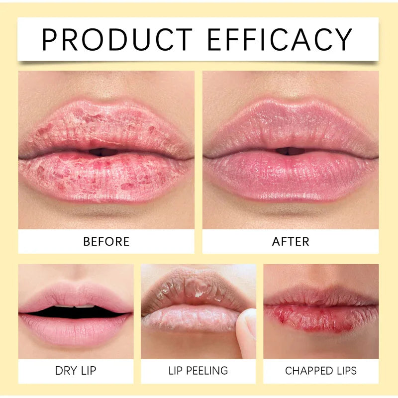 New Remove Dark Lip Balm Lightening Melanin Mask Gloss  Exfoliating Clean Moisturizer Korean Care Products Makeup Beauty Health